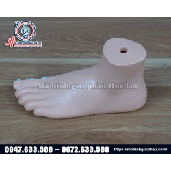 Mô hình bệnh lý bàn chân charcot